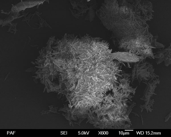 Kiselalger (Navicula) genom elektronmikroskop. Foto: Parvez Alam. 